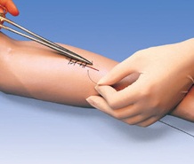 sutura-quirurgica
